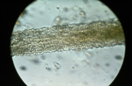 Meat handling: translucent ringworm spores around