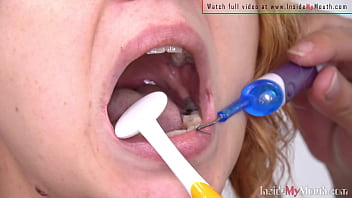in the mouth, mouth, cavity, dentist fetish