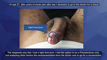 surgery, frenulum, uncircumcised, foreskin
