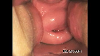 deepthroat, huge, cervix, jilmek