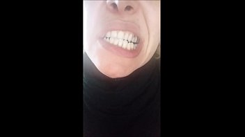 milf, rotten teeth, chantal channel, mouth fetish