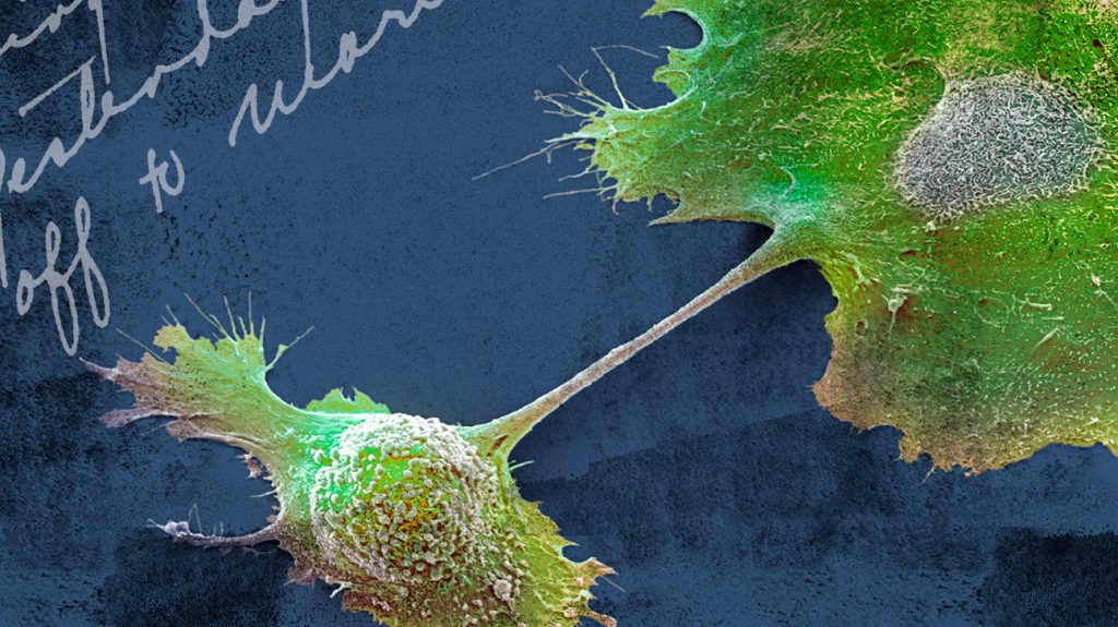 Green pancreatic cancer cells over a dark blue background 1