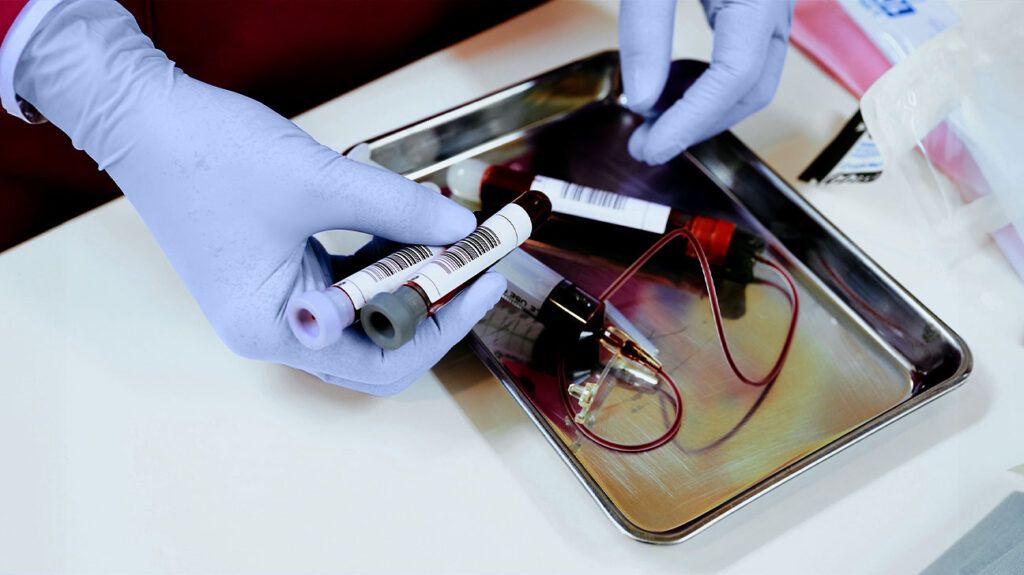 gloved hands handling blood vials in lab